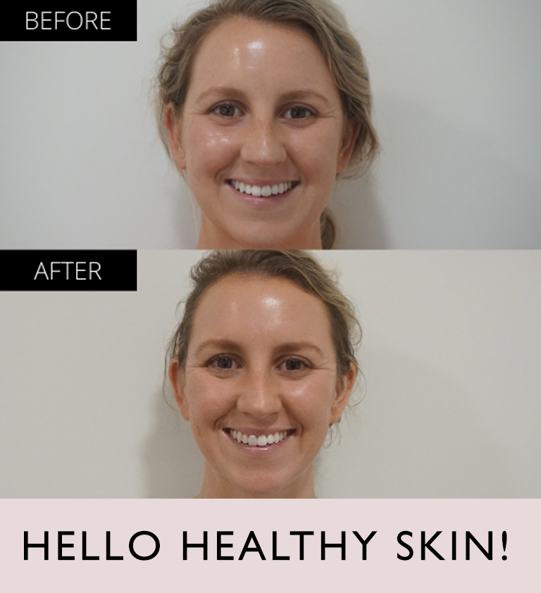 Facial2